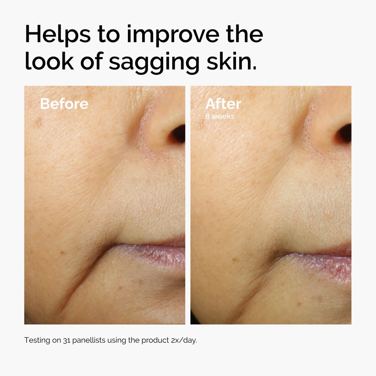 caffeine-3-escin-1-face-serum-z4 ord-caffeine-3pct-escin-1pct-face-serum-before-after-sagging.jpg