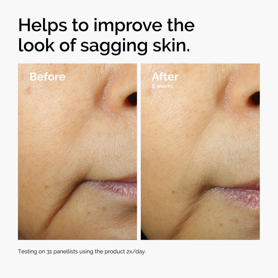 caffeine-3-escin-1-face-serum-z4 ord-caffeine-3pct-escin-1pct-face-serum-before-after-sagging.jpg
