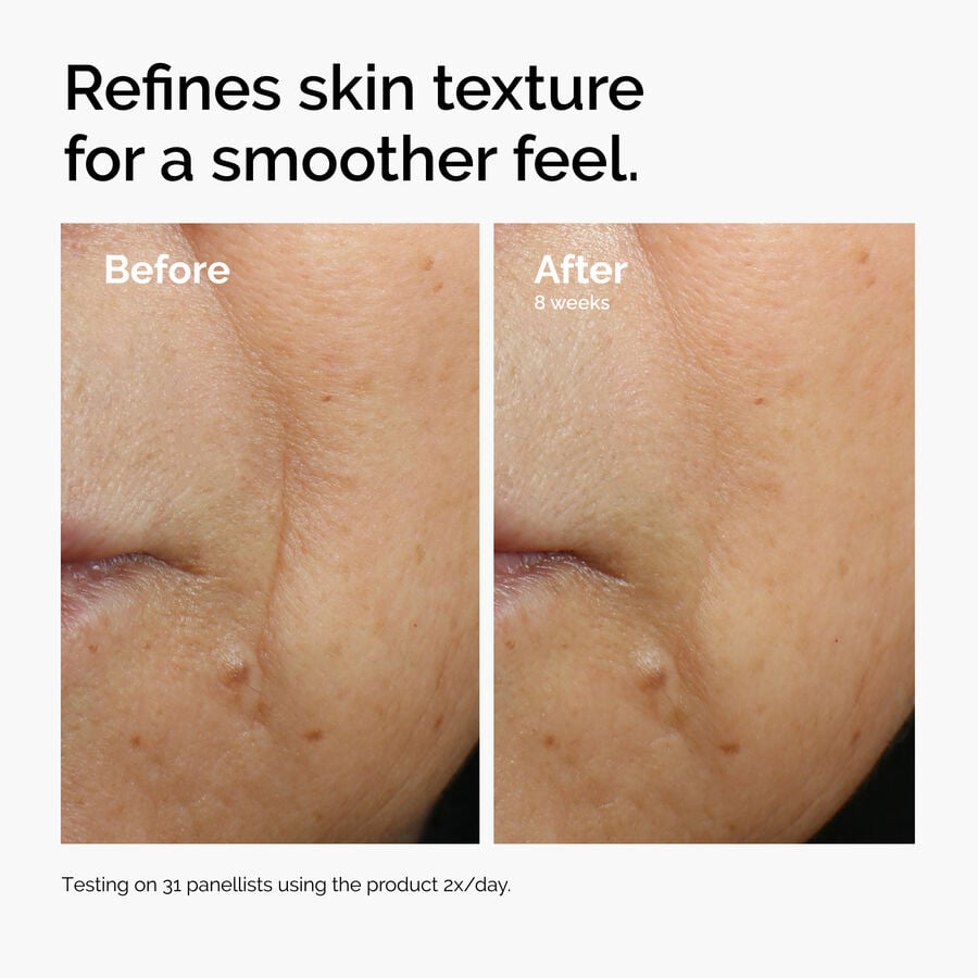 caffeine-3-escin-1-face-serum-z4 ord-caffeine-3pct-escin-1pct-face-serum-before-after-texture.jpg