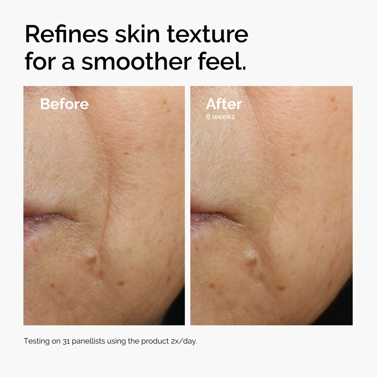 caffeine-3-escin-1-face-serum-z4 ord-caffeine-3pct-escin-1pct-face-serum-before-after-texture.jpg