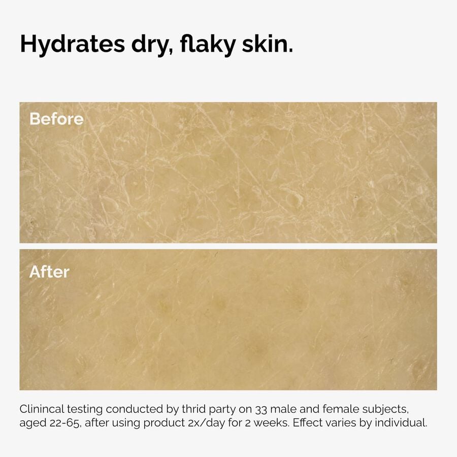the-body-care-collection-v1 ord-natural-moisturizing-factors-inulin-body-before-after-graphic-02.jpg