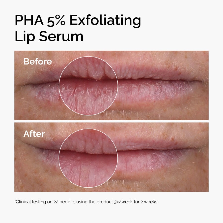 pha-5-exfoliating-lip-serum-p7 ord-pha-5pct-lip-exfoliating-serum-before-after.jpg