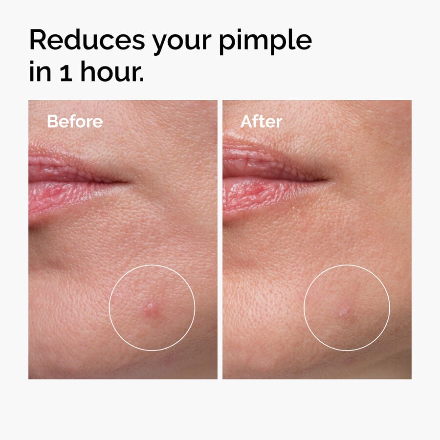 sulfur-10-powder-to-cream-concentrate-a5 ord-sulfur-10pct-powder-to-cream-concentrate-before-after-NA.jpg