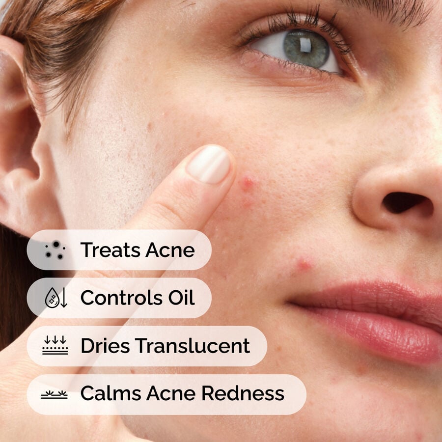 sulfur-10-powder-to-cream-concentrate-a5 ord-sulfur-10pct-powder-to-cream-concentrate-model-application-with-benefits-acne.jpg